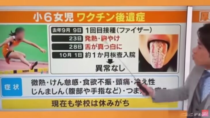 新型コロナウイルス感染症と蕁麻疹