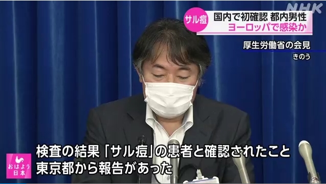 ついに日本国内でサル痘の感染者が見つかる！WHOが「緊急事態」を宣言した矢先！すでに複数の感染者が日本国内に入ってきている可能性も！→ネット「シナリオ通り」